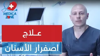 علاج اصفرار الاسنان