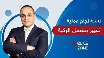 نسبة نجاح عملية تغيير مفصل الركبة
