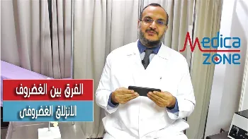 هل يوجد فرق بين الانزلاق الغضروفى والغضروف