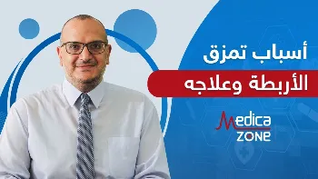اسباب تمزق الاربطة وعلاجه