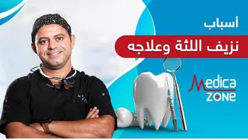 أسباب نزيف اللثة ووسائل علاجه