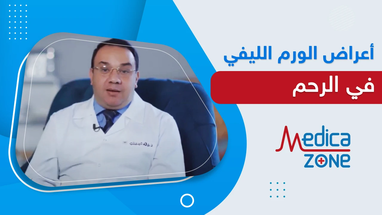 اعراض الورم الليفي في الرحم مضاعفاته وطرق الوقاية منه