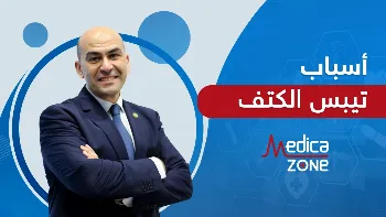 أسباب تيبس الكتف