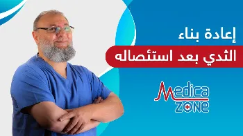 سر عمليات إعادة بناء الثدي بعد استئصاله.. السيليكون