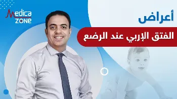اعراض الفتق الاربي عند الرضع