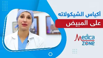 اكياس الشوكولاتة على المبيض وفرص الحمل | هل تؤثر على الحمل ومخزون المبيض؟