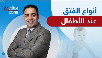 ما هي انواع الفتق عند الاطفال؟ واسبابه وعلاجه