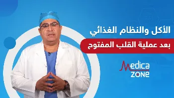 الاكل والنظام الغذائي بعد عملية القلب المفتوح