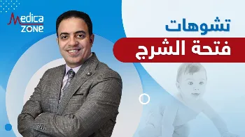 ما هي تشوهات المستقيم وفتحة الشرج عند الأطفال؟