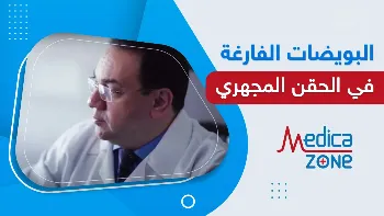 هل يمكن علاج البويضات الفارغة؟