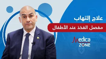 علاج التهاب مفصل الفخذ عند الاطفال