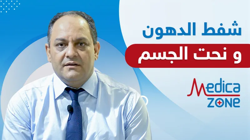 خلفية ميديكازون