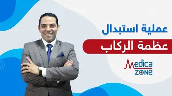 عملية استبدال عظمة الركاب