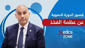 قصور الدورة الدموية في رأس عظمة الفخذ (مرض بيرثز)