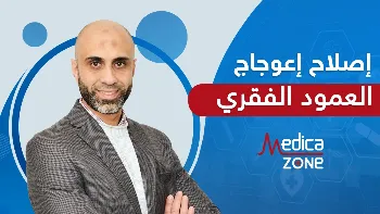 كيف يتم إجراء عملية اصلاح اعوجاج العمود الفقري؟