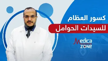 كيفية تشخيص كسور العظام لدى الحوامل والوقاية منها