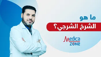 ما هو الشرخ الشرجي؟ وما أسبابه؟