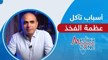 ما أسباب تآكل رأس عظمة الفخذ؟ وهل يمكن علاجها بدون جراحة؟