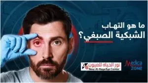 خلفية ميديكازون