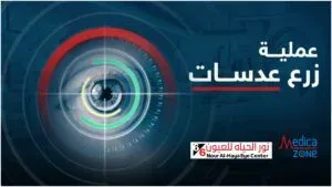 خلفية ميديكازون