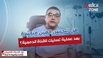 هل تتحسن العين مباشرة بعد عملية تسليك القناة الدمعية؟