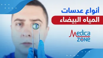 أنواع عدسات المياه البيضاء.. منها العدسات الأمريكية متعددة البؤر والـ ICL
