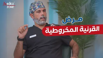 أهمية إجراء فحص القرنية دوريًا