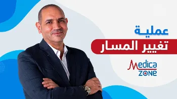 عمليات تحويل المسار| أمل جديد لمرضى السمنة