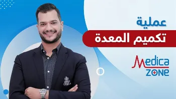 الفرق بين عملية تكميم المعدة المقوى والتكميم التقليدي
