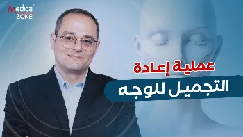 هل تسبب عمليات شد الوجه آثارًا جراحية واضحة؟