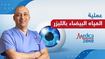 ما الوقت المناسب لإجراء عملية المياه البيضاء؟