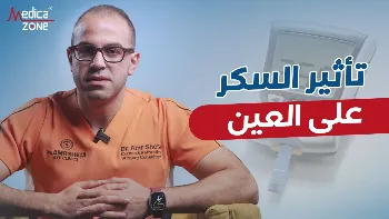 تاثير السكر على العين: كيف يؤثر مرض السكر في صحة الإبصار؟