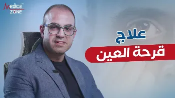 أهمية علاج قرحة العين