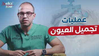 عمليات تجميل العيون| عندما يتحول الإجراء التجميلي إلى هوس