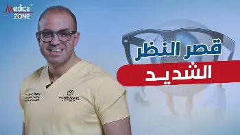 هل تصلح عملية الليزك في علاج قصر النظر الشديد؟