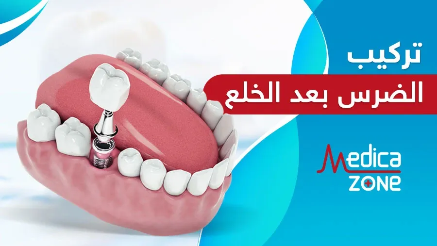 خلفية ميديكازون