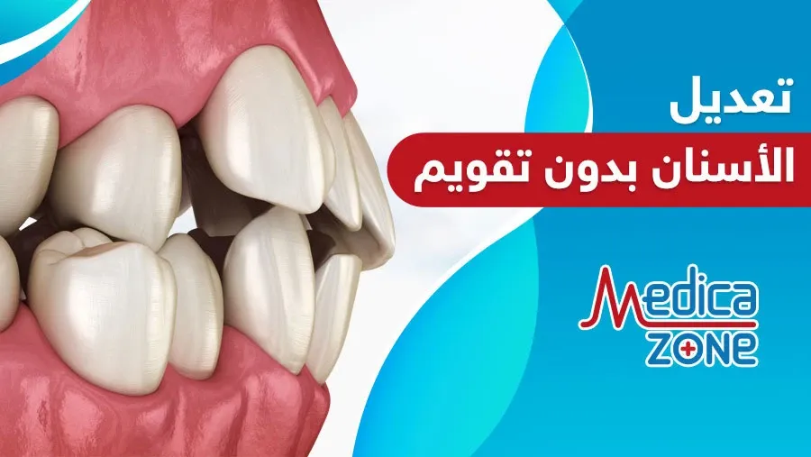 خلفية ميديكازون