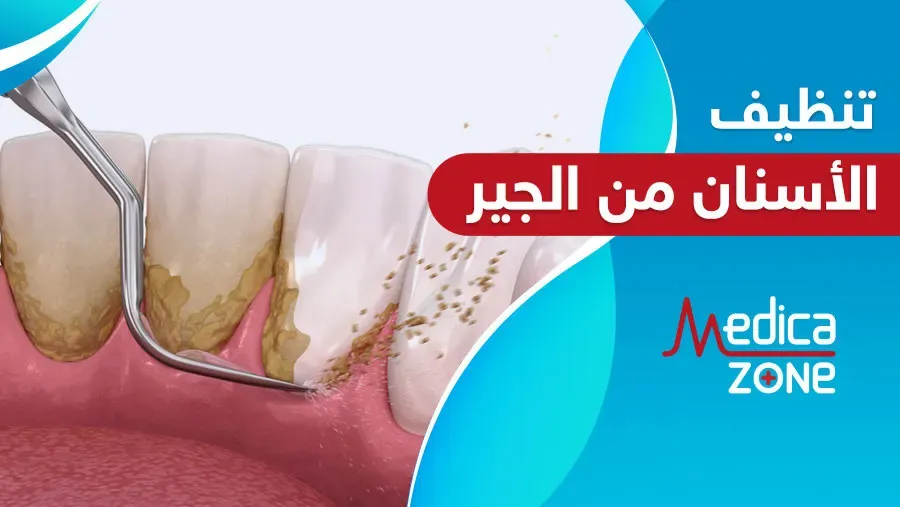 خلفية ميديكازون