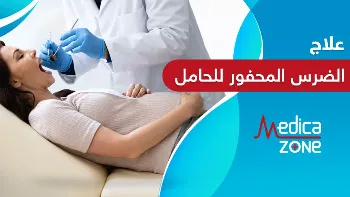 هل يُمكن علاج الضرس المحفور للحامل؟
