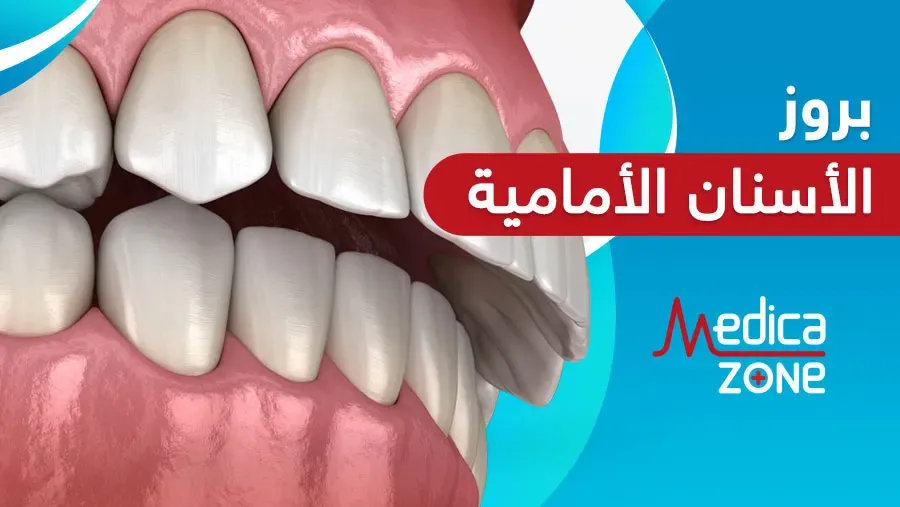 خلفية ميديكازون