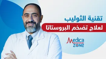 علاج تضخم البروستات باستخدام تقنية الثوليب