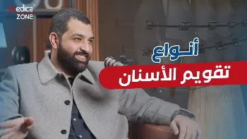 انواع تقويم الاسنان دورها في إصلاح مشكلات الأسنان المختلفة