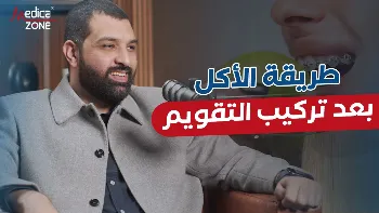 أهمية استخدام مثبت الاسنان بعد التقويم 