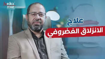 متى ينبغي إجراء عملية الانزلاق الغضروفي؟