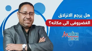 هل يرجع الانزلاق الغضروفي إلى مكانه؟