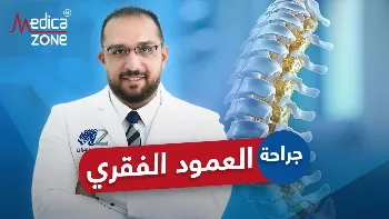 جراحة العمود الفقري| التخصص المسؤول وأنواع العمليات الجراحية