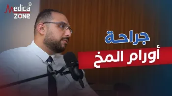 تقنيات جراحة اورام المخ
