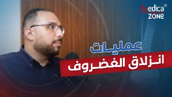 ما أنواع عمليات انزلاق الغضروف؟