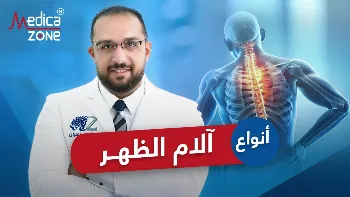 ما انواع الام الظهر المختلفة؟ وما أسبابها؟