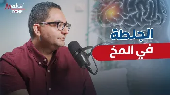 الجلطة في المخ: الأعراض والعلاج في الساعات الأولى